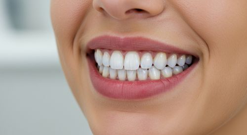 Porcelain Veneers